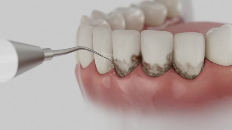 Reliable Dental contractor in Bismarck, ND by Smile Center Dentistry
